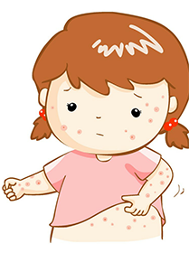 夏季孩子皮膚奇癢 是濕疹嗎？